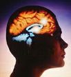 Cerebro