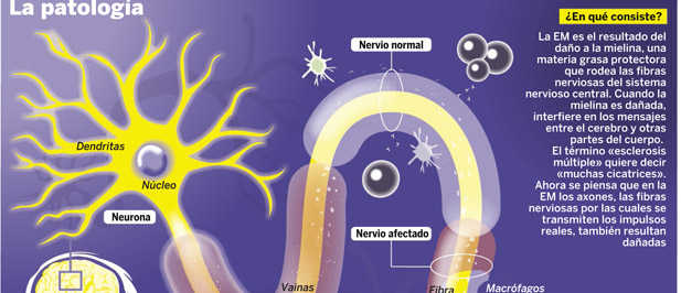 Tratamiento oral Tratamiento oral